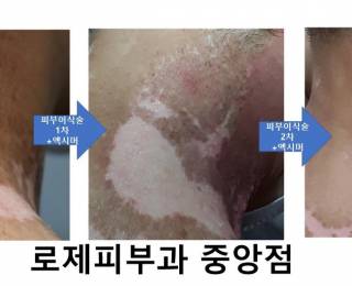 전후사진