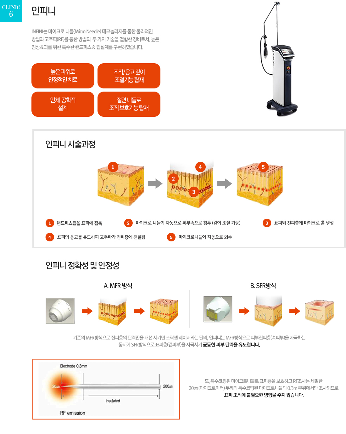 laser5. 인피니