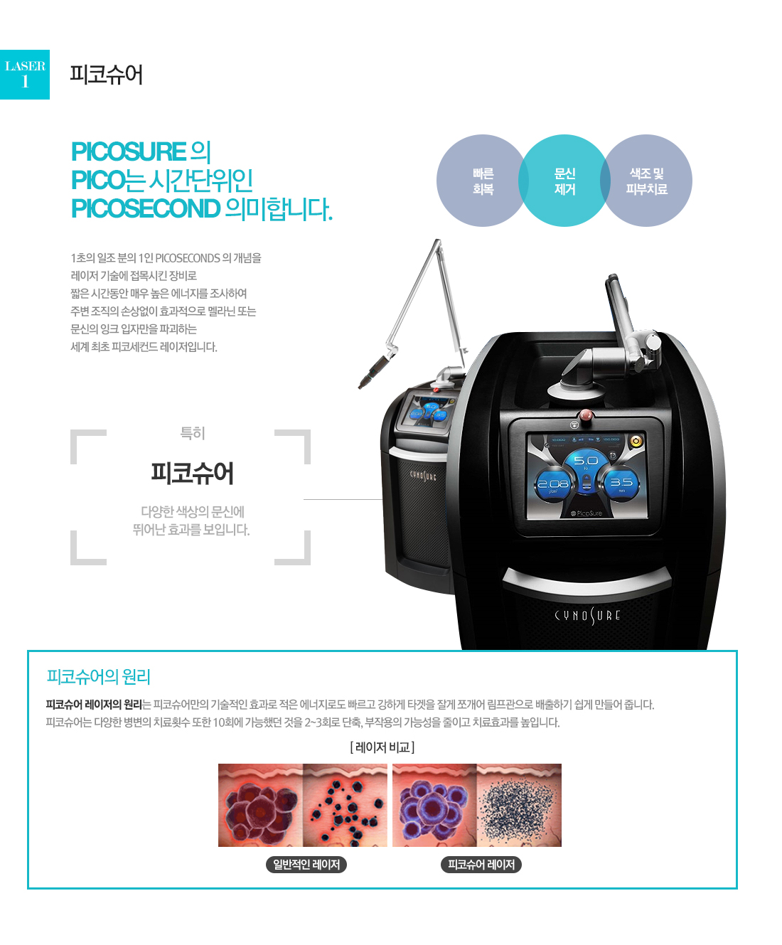 laser1. 피코슈어