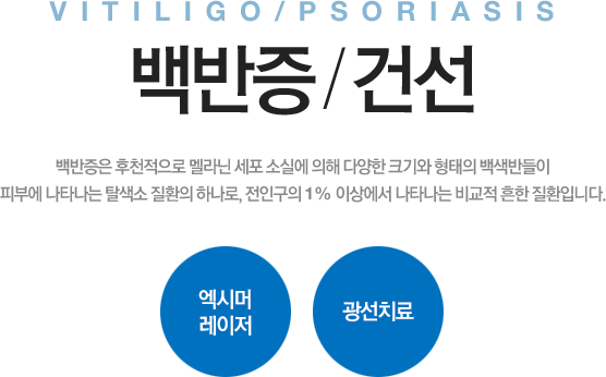 vitiligo/psoriasis 백반증/건선