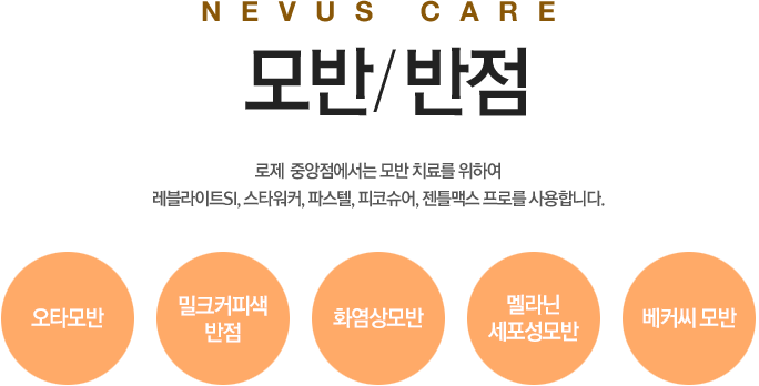 nevus care 모반/반점