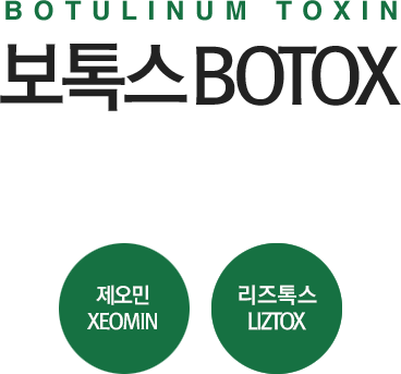 melasma 보톡스